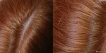 Капус 7.43 фото на волосах